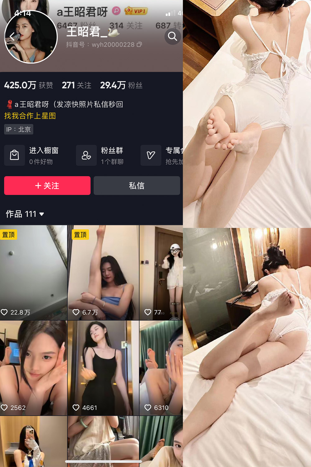 抖音 王昭君 微密圈 NO.023期 【29P6V】最新至：2024.6.6 第1张