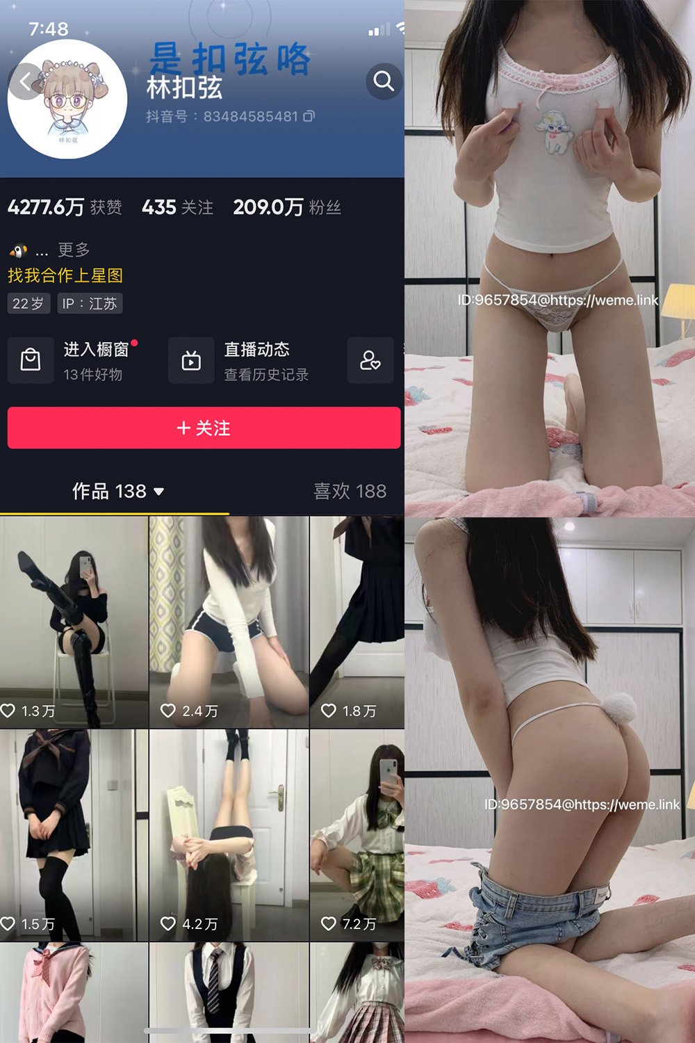 抖音 林扣弦 微密圈 NO.070期 【25P】最新至：2024.9.25 第1张